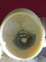 Metal washer in Customhouse doll head